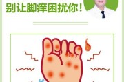 王者荣耀中“脚气”梗的含义是什么？